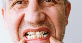 What is Periodontitis?